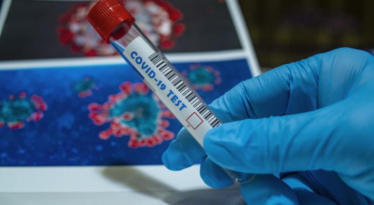 Ölkədə 122 nəfər koronavirusa yoluxub, ölüm qeydə alınmayıb - FOTO
