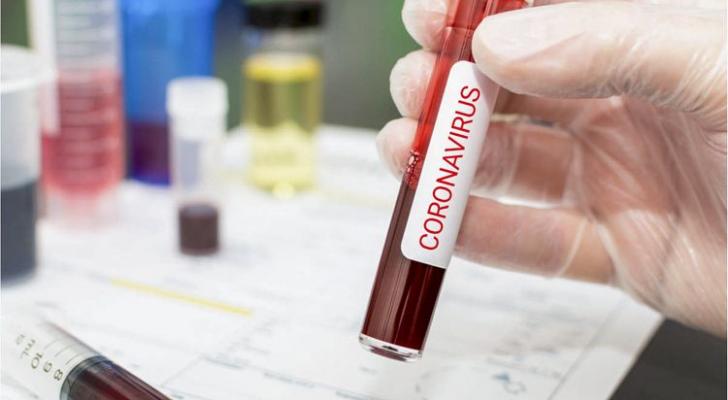 Gürcüstanda daha 569 nəfər koronavirusa yoluxub, 11 nəfər ölüb