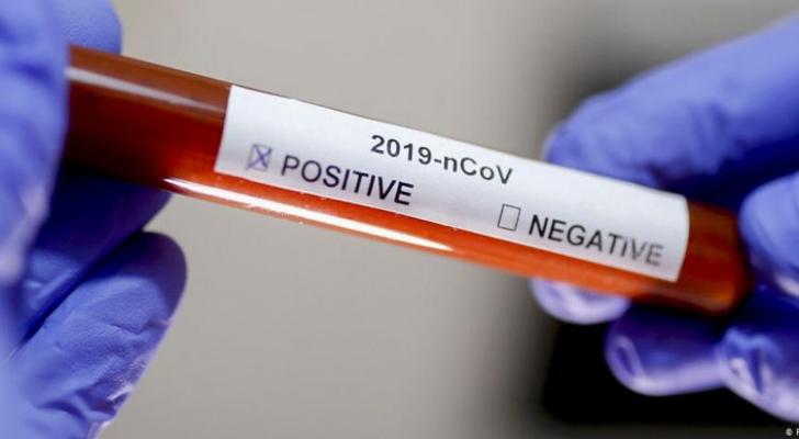 Gürcüstanda daha 36 nəfər  koronavirusdan ölüb
