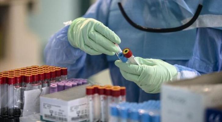 Daha 35 nəfər koronavirusdan öldü: 3712 yeni yoluxma - FOTO