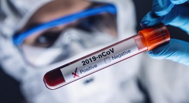Azərbaycanda koronavirusa daha 4 381 yoluxma qeydə alınıb, 47 nəfər ölüb