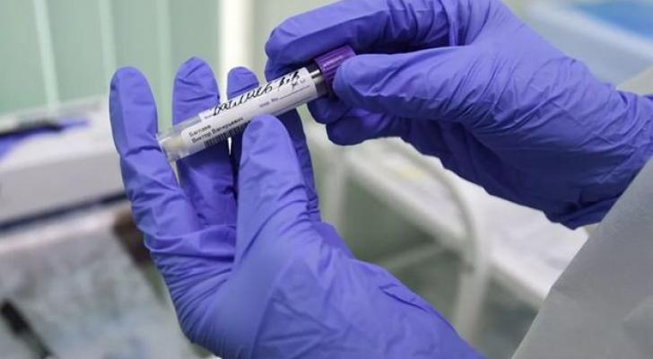 Britaniyada son sutkada koronavirusa 57 mindən çox yoluxma