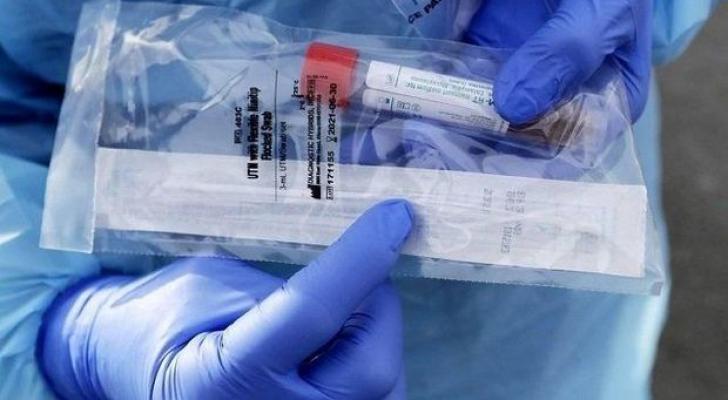 Daha 21 nəfər koronavirusdan öldü: 633 yeni yoluxma - FOTO