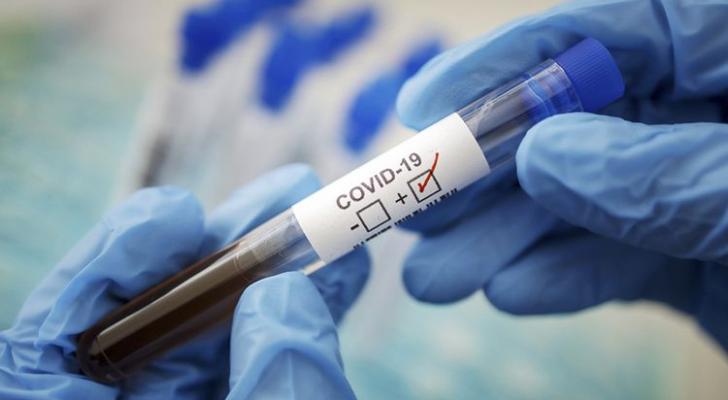 Koronavirusa yoluxanların sayı yenidən azaldı - FOTO