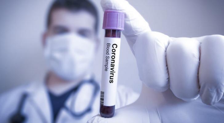 1 429 nəfər koronavirusa yoluxub,17 nəfər vəfat edib - FOTO