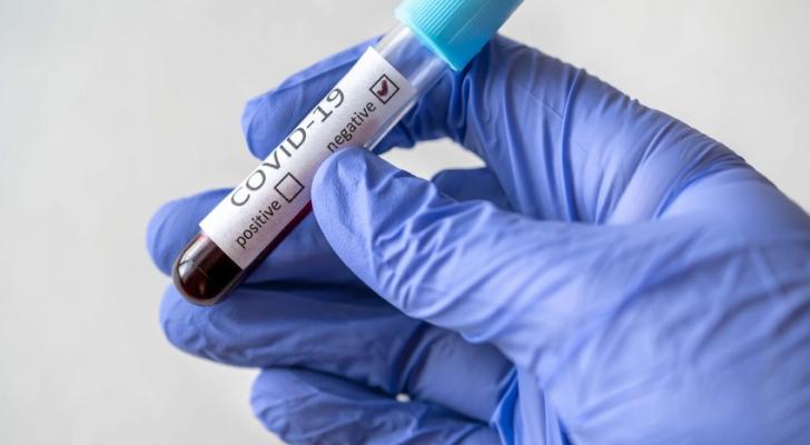 Koronavirusa 2 361 yeni yoluxma qeydə alınıb, 24 nəfər ölüb