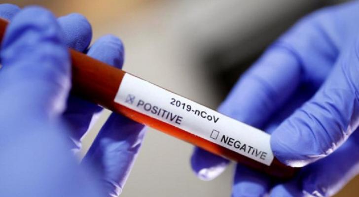 Koronavirusa yoluxanların sayı açıqlandı – FOTO