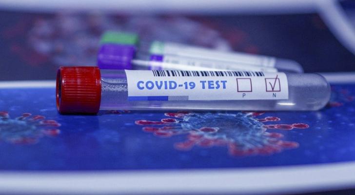 Son sutkada koronavirusa yoluxanların sayı açıqlandı