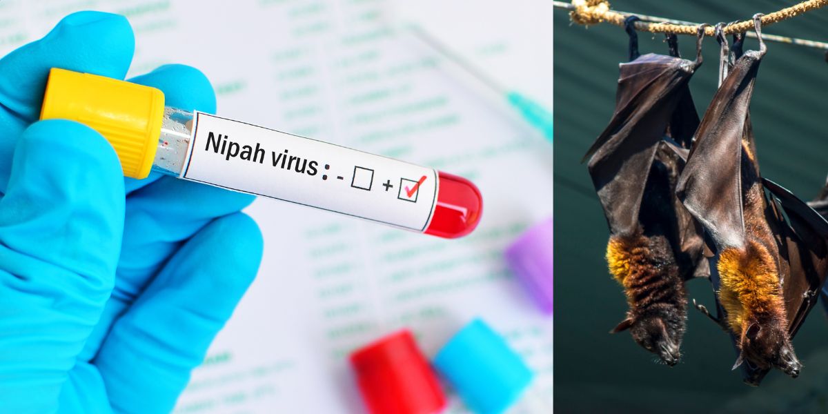 Hindistanda Nipah virusuna yoluxma nəticəsində ilk ölüm halı qeydə alınıb