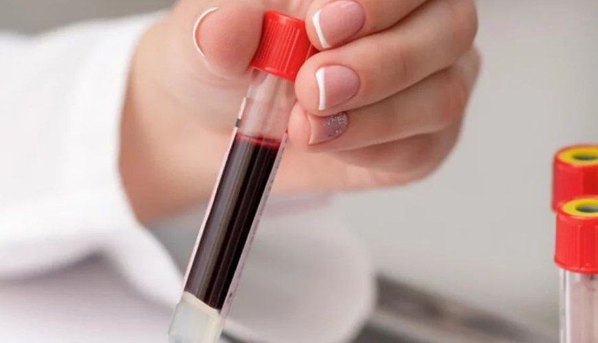 Azərbaycana qan qazı müayinələri üçün laboratoriya testləri gətiriləcək