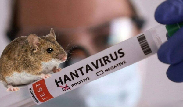 Argentinada hantavirusun mənbəyi araşdırılacaq
