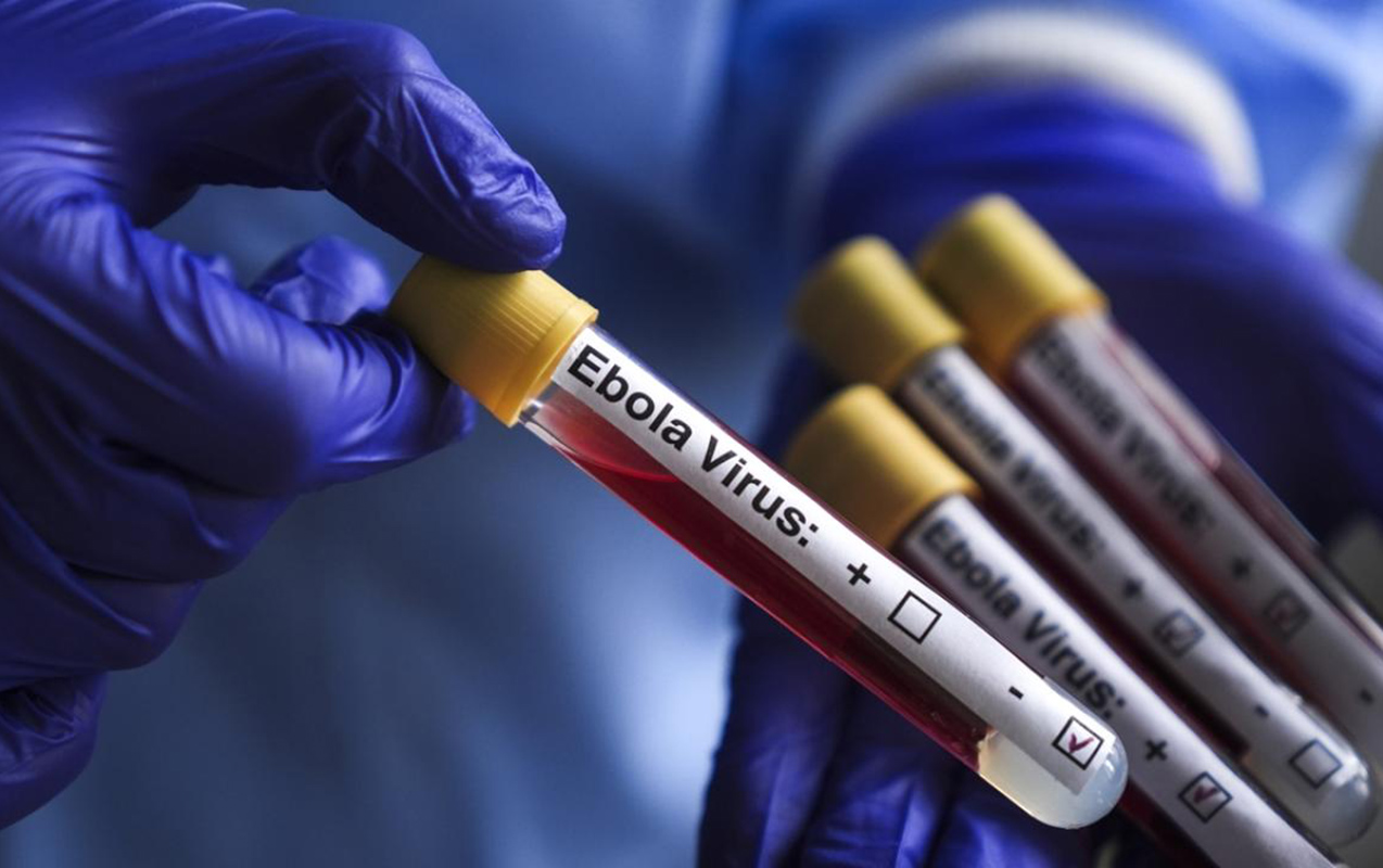 ABŞ-də Ebola ilə bağlı xəbərdarlıq edilib