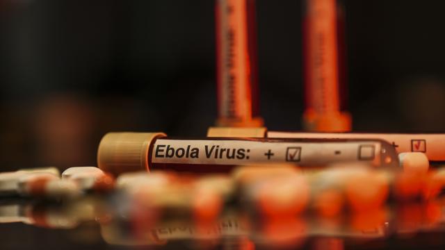 BMT: Konqoda Ebola epidemiyası daha 1 milyon nəfəri yoxsulluğa sürükləyə bilər