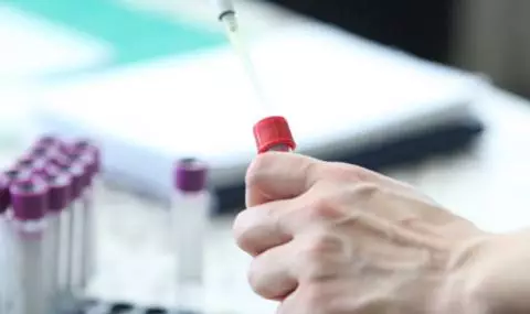 İspaniya hökuməti Covid-19 epidemiyasının bitdiyini elan edib