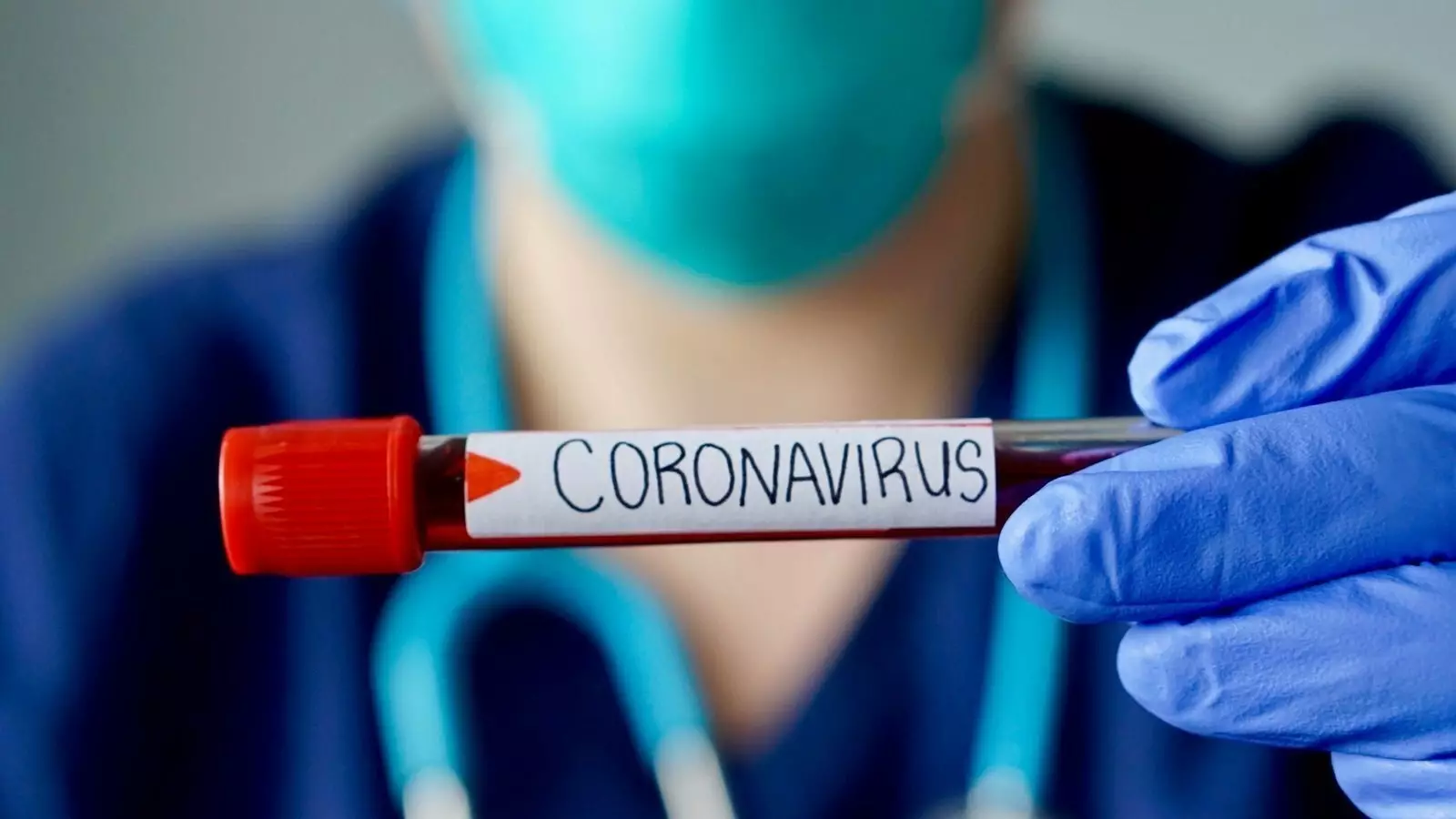 Azərbaycanda neçə nəfər koronavirusa yoluxub?