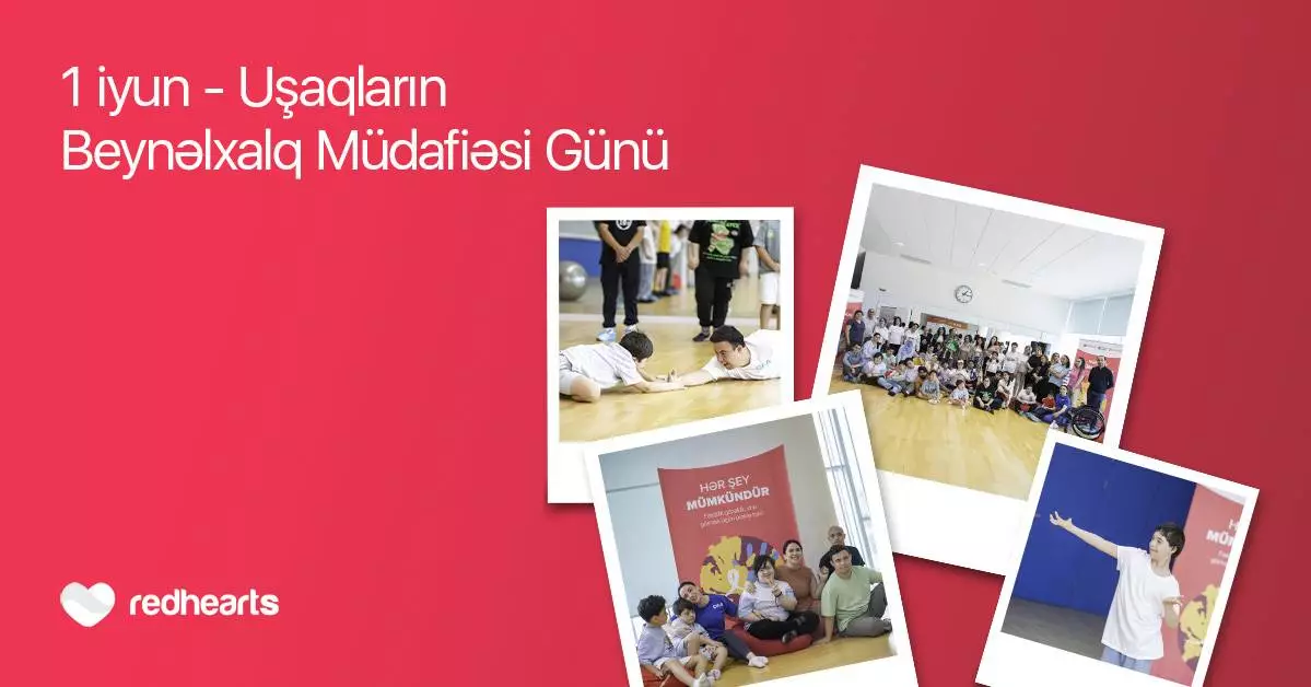 Hər şey mümkündür: Daun sindromlu uşaqlar üçün sosial layihə