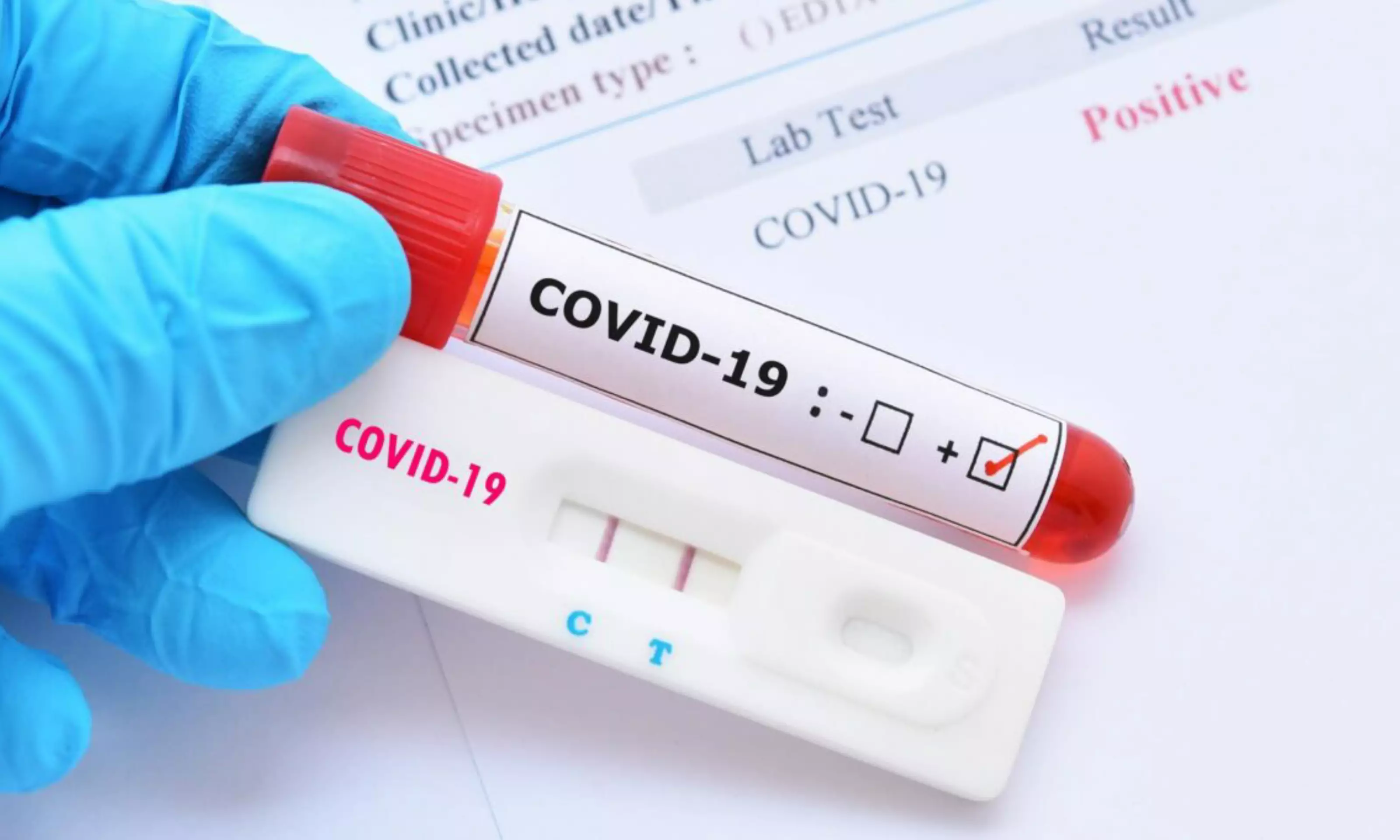 Ölkədə neçə koronavirus xəstəsi var?