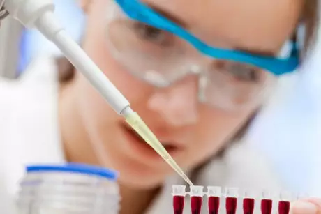 TƏBİB bakterioloji testlərə 14,6 mln. manat xərcləyəcək - SİYAHI