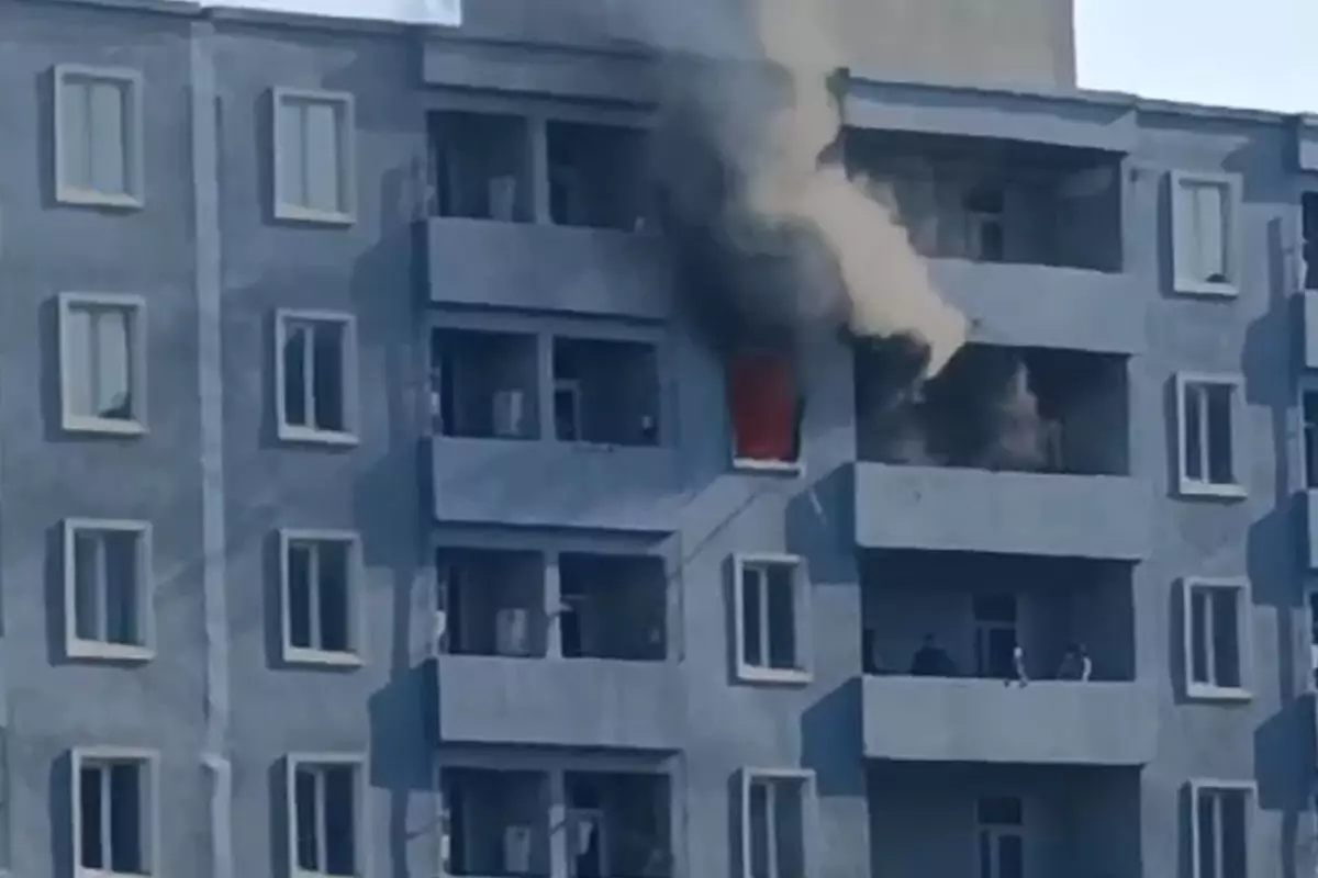 Saraydakı yanğında xəsarət alan şəxsin durumu açıqlanıb