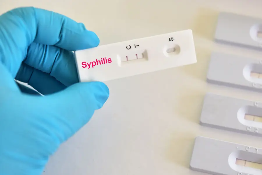 Slovakiyada "sifilis dalğası" əhalini qorxudub