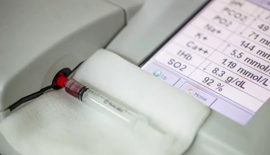 Azərbaycan 4 mln. manatlıq qan qazı testi alır