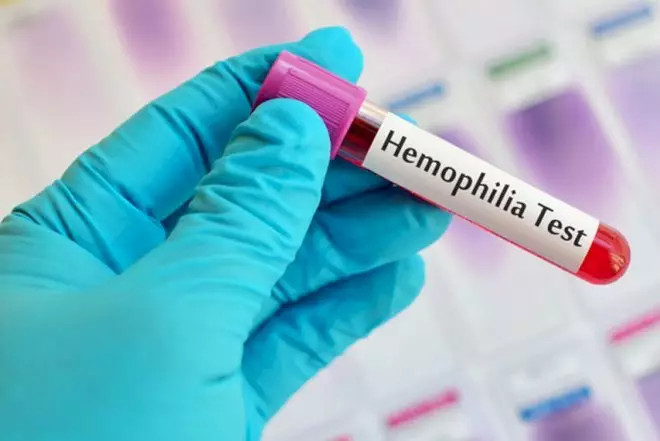 Bu il hemofiliya xəstələrinin müalicəsi üçün dərmanlara 16 mln. manat xərclənəcək