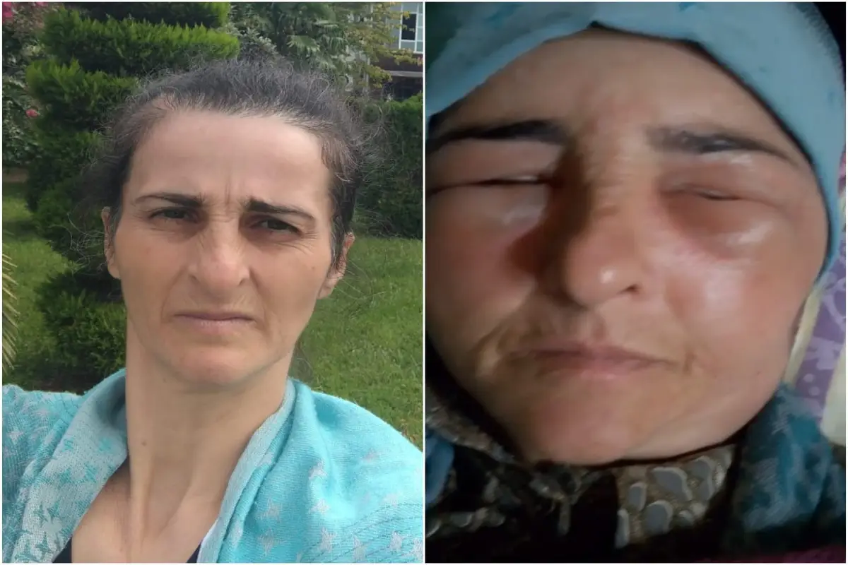Lənkəranda qonşular arasında dava olub, xəsarət alan var
