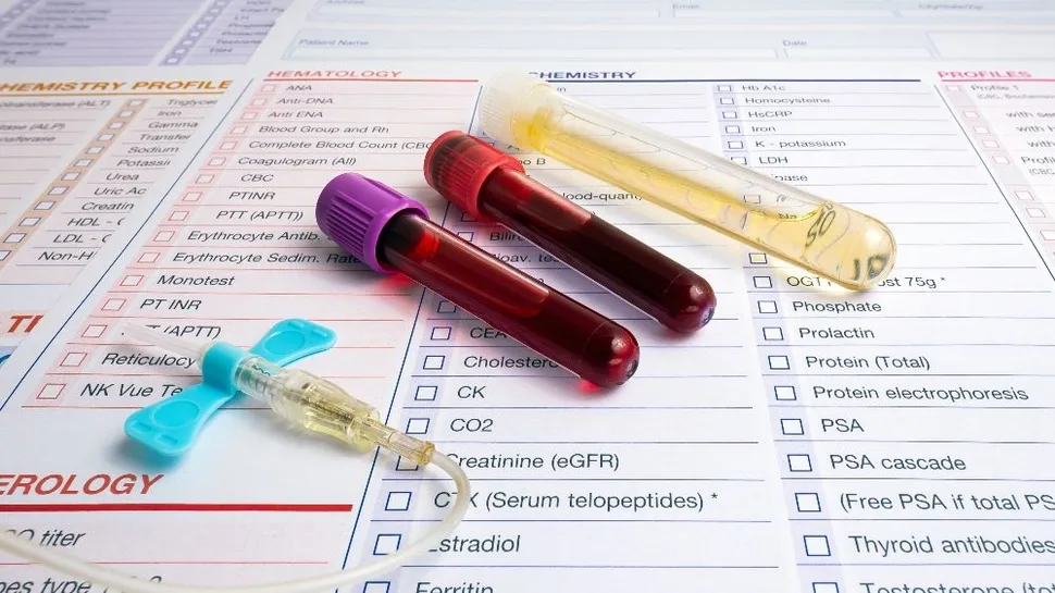 Qan xərçəngi ilə bağlı yeni genetik test üsulu hazırlandı
