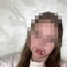 TikTok-da yeniyetmələr arasında təhlükəli trend yayılıb - VİDEO