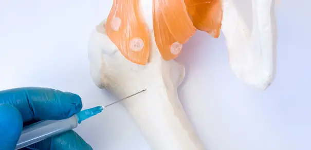 Azərbaycanla Türkiyə arasında sümük iliyi transplantasiyası ilə bağlı 5 milyonluq müqavilə imzalanıb