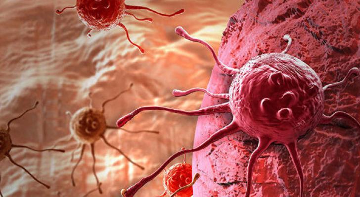 Xərçəng xəstəliyi ilə mübarizə üçün 46,4 milyon manat ayrılacaq