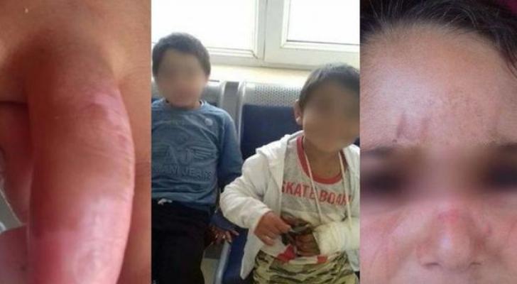 Azyaşlı övladlarına dəhşətli işgəncələr verən valideynlərlə bağlı - RƏSMİ AÇIQLAMA
