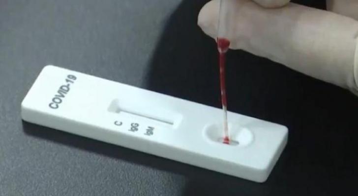 Rusiyada son 24 saatda COVID-19-a rekord sayda yoluxma halı qeydə alındı