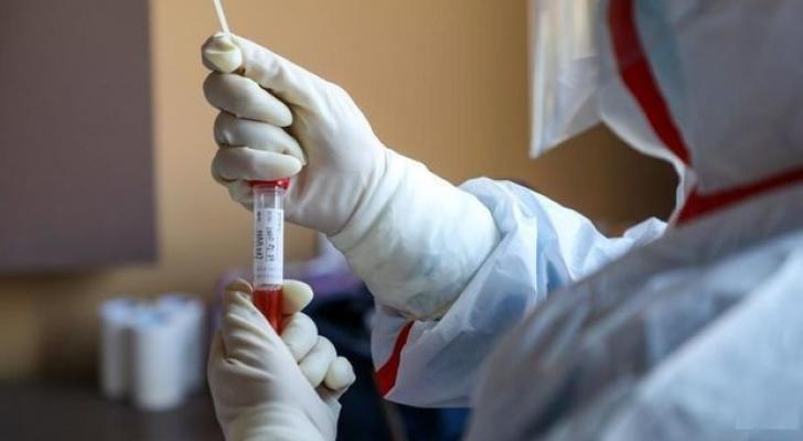 Azərbaycanda koronavirusdan daha bir nəfər öldü: 76 yeni yoluxma - RƏSMİ