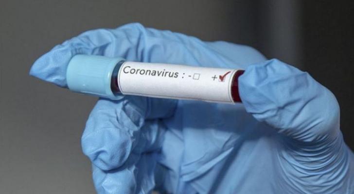 Azərbaycanda daha 56 nəfərdə koronavirus aşkarlanıb