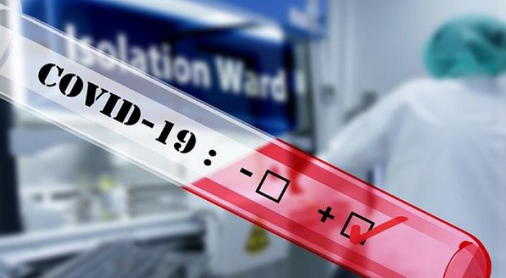 Azərbaycanda daha 44 nəfərdə koronavirus aşkarlandı - 1 nəfər vəfat etdi, 74 nəfər sağaldı