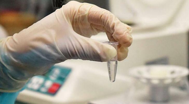 Dünyada koronavirus daşıyıcılarının sayı 5 milyonu ötdü