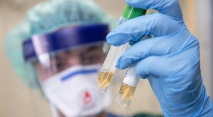 Rusiya koronavirus dərmanının ixracına başladı
