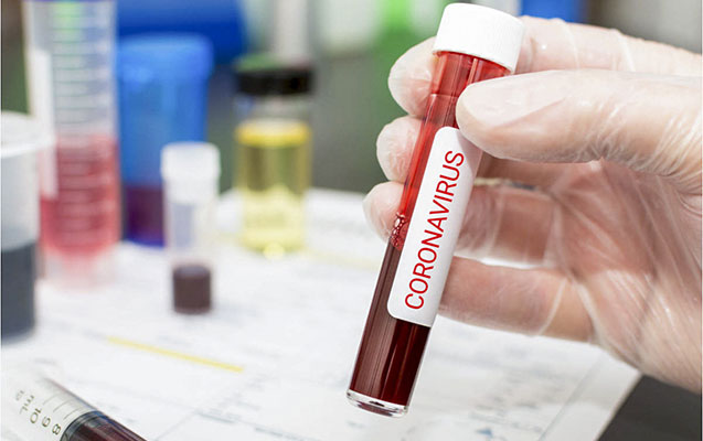 Koronavirusa 19 yeni yoluxma qeydə alınıb