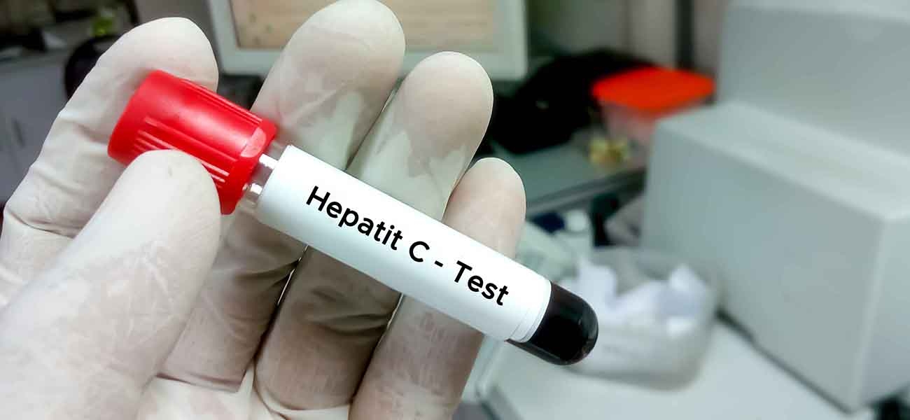 Alimlər hepatit C virusunun hüceyrələrə necə yoluxduğunu tapıblar