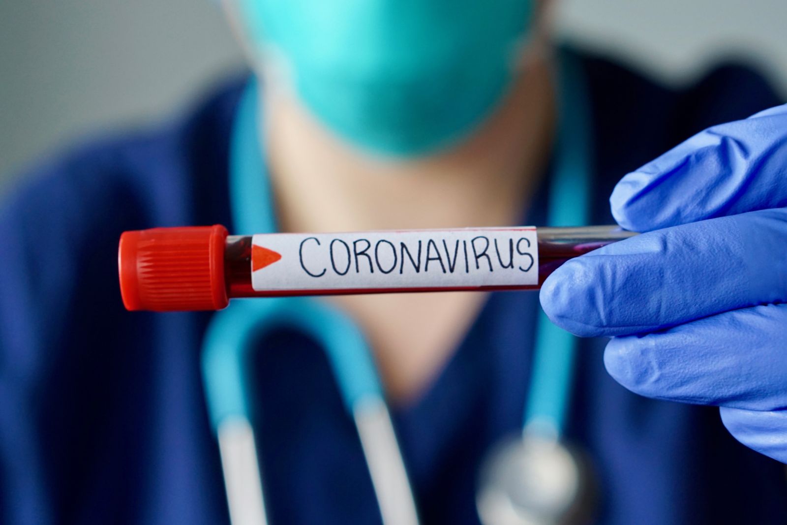 Dünyada koronavirusa yoluxma halları 52 % artıb